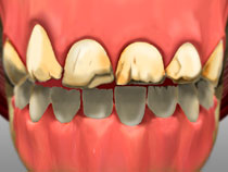 full_mouth_rotation