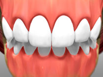full_mouth_rotation_done