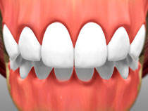 full_mouth_rotation_done